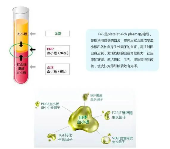 PRP技术骨病疼痛及美容临床应-广州